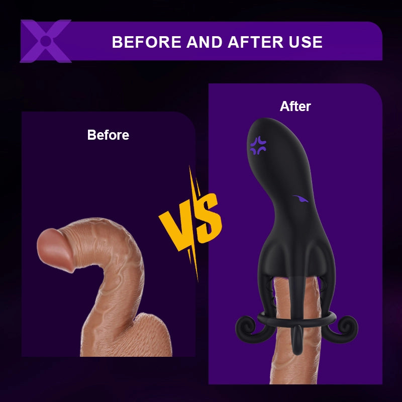 XG11 Octopus Glans Trainer 10 Vibration Male Sex Toy